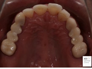 正常な歯列、治療の必要な歯列とは？