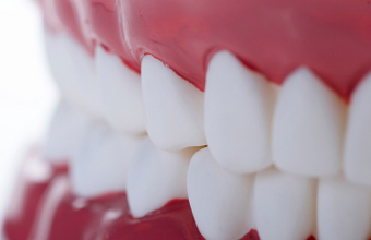 虫歯の原因は3ヶ月周期で成長します
